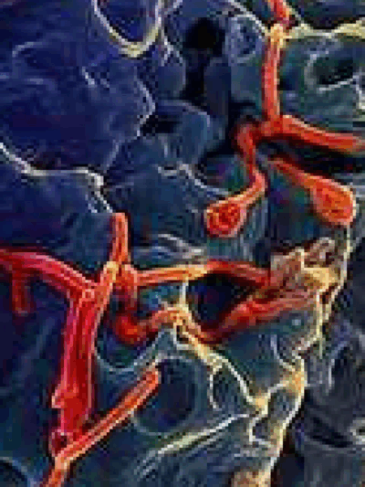 ebola