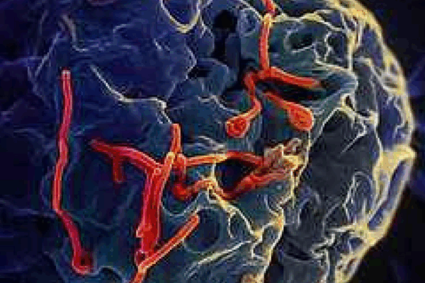 ebola